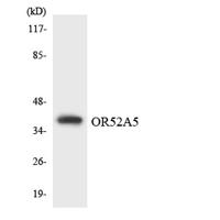 Olfactory receptor 52A5 Polyclonal Antibody