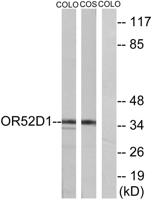 Olfactory receptor 52D1 Polyclonal Antibody