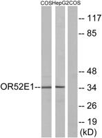 Olfactory receptor 52E1 Polyclonal Antibody