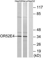 Olfactory receptor 52E4 Polyclonal Antibody