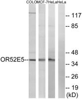 Olfactory receptor 52E5 Polyclonal Antibody