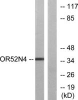 Olfactory receptor 52N4 Polyclonal Antibody