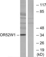 Olfactory receptor 52W1 Polyclonal Antibody