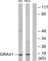 ORAOV1 Polyclonal Antibody