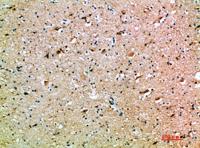 OSM Polyclonal Antibody