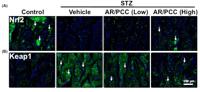 Nrf2 Polyclonal Antibody