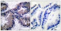 Nrf2 Polyclonal Antibody