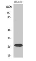 NRIP3 Polyclonal Antibody