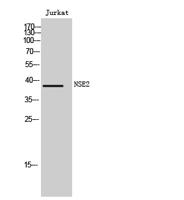 NSE2 Polyclonal Antibody