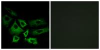 NT5C1A Polyclonal Antibody