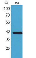 NTCP Polyclonal Antibody