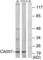 NTPase Polyclonal Antibody