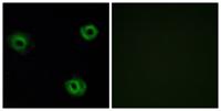 NTR2 Polyclonal Antibody