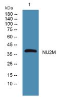 NU2M Polyclonal Antibody