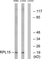 Ribosomal Protein L15 Polyclonal Antibody