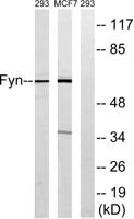 Fyn Polyclonal Antibody