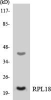 Ribosomal Protein L18 Polyclonal Antibody