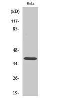 Nucleophosmin Polyclonal Antibody