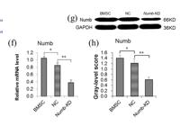 NUMB Polyclonal Antibody