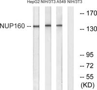 Nup160 Polyclonal Antibody