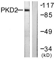 PKD2 Polyclonal Antibody