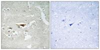 PKI β Polyclonal Antibody