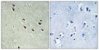 NXF3 Polyclonal Antibody