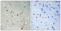 NY-CO-1 Polyclonal Antibody