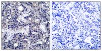 PKR Polyclonal Antibody