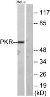 PKR Polyclonal Antibody