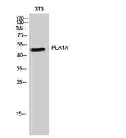 PLA1A Polyclonal Antibody