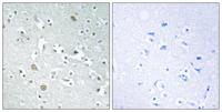 PLA1A Polyclonal Antibody