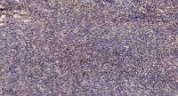 PLB Polyclonal Antibody