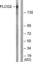 PLC γ2 Polyclonal Antibody