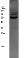 OAT1 Polyclonal Antibody