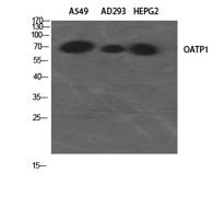 OATP1 Polyclonal Antibody