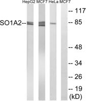 OATP1 Polyclonal Antibody