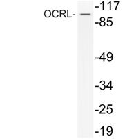 OCRL Polyclonal Antibody