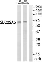 OCTN2 Polyclonal Antibody