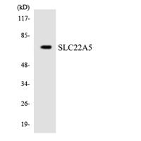 OCTN2 Polyclonal Antibody