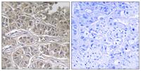 ODC Polyclonal Antibody