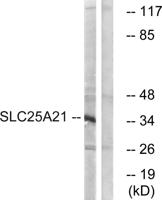 ODC Polyclonal Antibody