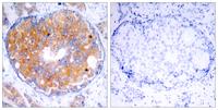 MEK-2 Polyclonal Antibody