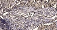 MEK-3 Polyclonal Antibody