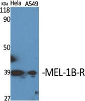 MEL-1B-R Polyclonal Antibody