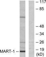 Melan-A Polyclonal Antibody