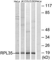 Ribosomal Protein L35 Polyclonal Antibody