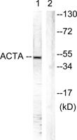 Actin-α/γ Polyclonal Antibody