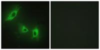 ACTR-IB Polyclonal Antibody