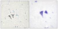 ACTR-IC Polyclonal Antibody